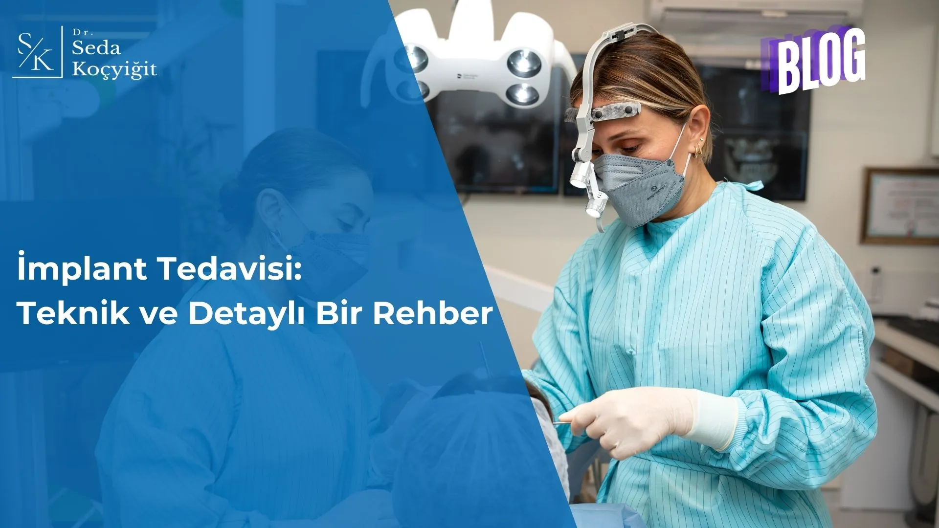 İmplant Tedavisi Teknik ve Detaylı Bir Rehber